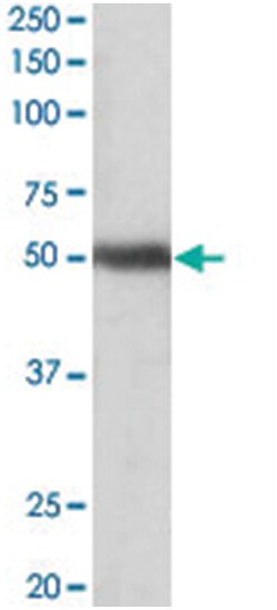 GPR83 Goat anti-Human, Polyclonal Antibody, Abnova 100 &mu;g | Buy Online | Abnova Corporation | Fisher Scientific