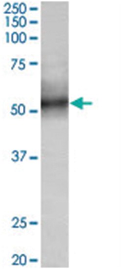 TRIM11 Goat anti-Human, Polyclonal Antibody, Abnova 100 &mu;g | Buy Online | Abnova Corporation | Fisher Scientific