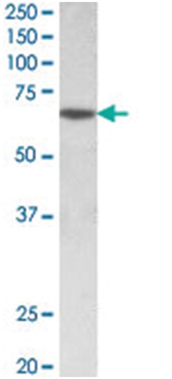 SOX11, Goat, Polyclonal Antibody, Abnova 100 &mu;g | Buy Online | Abnova Corporation | Fisher Scientific