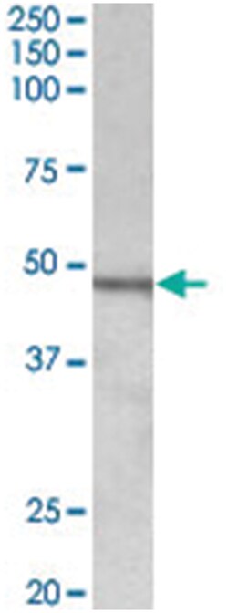 CHIT1, Goat, Polyclonal Antibody, Abnova 100 &mu;g | Buy Online | Abnova Corporation | Fisher Scientific