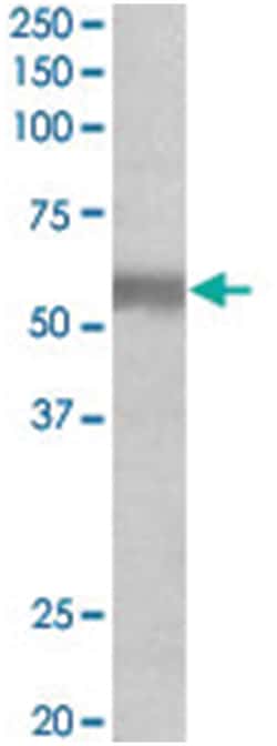 NPR3, Goat, Polyclonal Antibody, Abnova 100 &mu;g | Buy Online | Abnova Corporation | Fisher Scientific