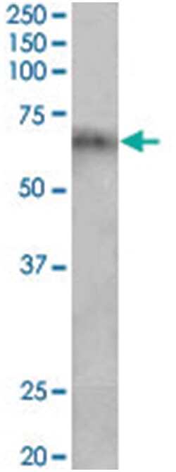 Cyp2d5, Goat, Polyclonal Antibody, Abnova 100&mu;g; Unlabeled:Antibodies,