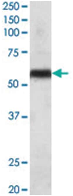 CYP2C8, Goat, Polyclonal Antibody, Abnova 100 &mu;g | Buy Online | Abnova Corporation | Fisher Scientific