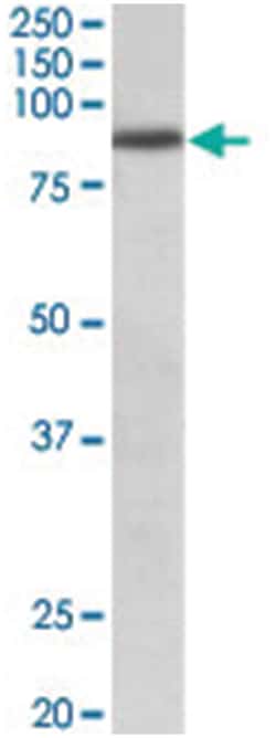 FGFR1 Goat anti-Human, Polyclonal Antibody, Abnova 100 &mu;g | Buy Online | Abnova Corporation | Fisher Scientific