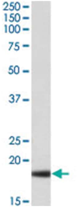 HP Goat anti-Human, Polyclonal Antibody, Abnova 100 &mu;g | Buy Online | Abnova Corporation | Fisher Scientific