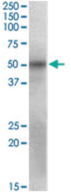POU3F1 Goat anti-Human, Polyclonal Antibody, Abnova 100 &mu;g | Buy Online | Abnova Corporation | Fisher Scientific