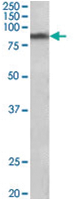 SLC6A3, Goat, Polyclonal Antibody, Abnova 100 &mu;g | Buy Online | Abnova Corporation | Fisher Scientific