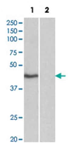TBP (isoform 1), Goat, Polyclonal Antibody, Abnova 100 &mu;g | Buy Online | Abnova | Fisher Scientific