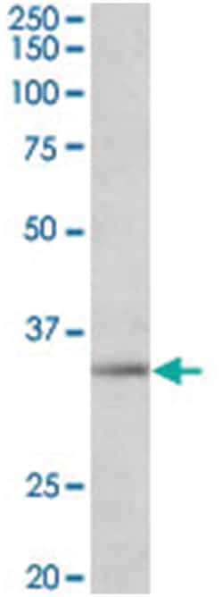 SPON2, Goat, Polyclonal Antibody, Abnova 100 &mu;g | Buy Online | Abnova Corporation | Fisher Scientific
