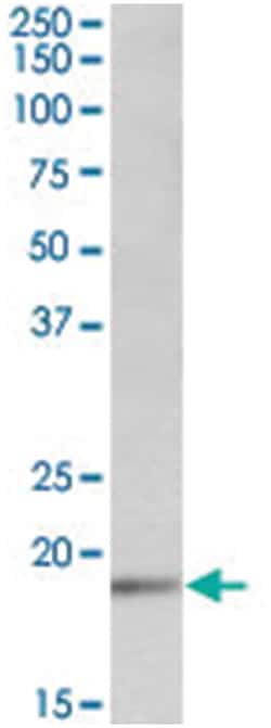 UBE2C Goat anti-Human, Polyclonal Antibody, Abnova 100 &mu;g | Buy Online | Abnova Corporation | Fisher Scientific