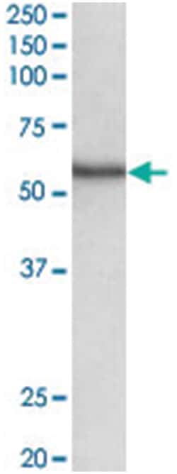STK38 Goat anti-Human, Rat, Polyclonal Antibody, Abnova 100 &mu;g | Buy Online | Abnova Corporation | Fisher Scientific