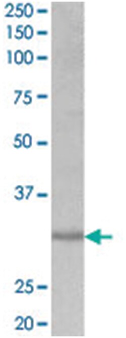 CRLS1, Goat, Polyclonal Antibody, Abnova 100 &mu;g | Buy Online | Abnova | Fisher Scientific
