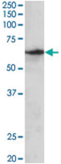 SLC47A2 Goat anti-Human, Polyclonal Antibody, Abnova 100 &mu;g | Buy Online | Abnova Corporation | Fisher Scientific