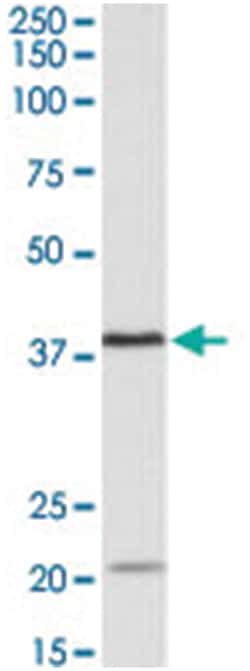 KLHDC8B, Goat, Polyclonal Antibody, Abnova 100 &mu;g | Buy Online | Abnova Corporation | Fisher Scientific