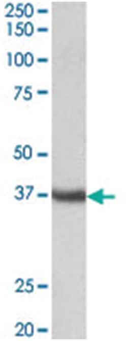 Clu Goat anti-Mouse, Rat, Polyclonal Antibody, Abnova 100 &mu;g | Buy Online | Abnova Corporation | Fisher Scientific