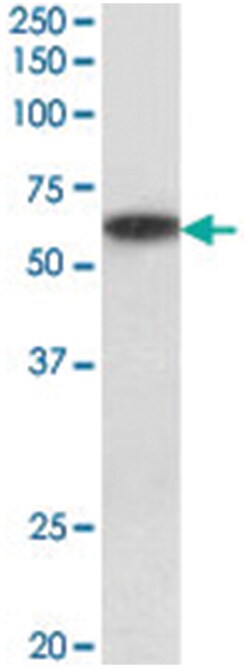 P2rx4, Goat, Polyclonal Antibody, Abnova 100 &mu;g | Buy Online | Abnova Corporation | Fisher Scientific