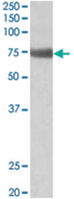 Tgm6, Goat, Polyclonal Antibody, Abnova 100 &mu;g | Buy Online | Abnova Corporation | Fisher Scientific