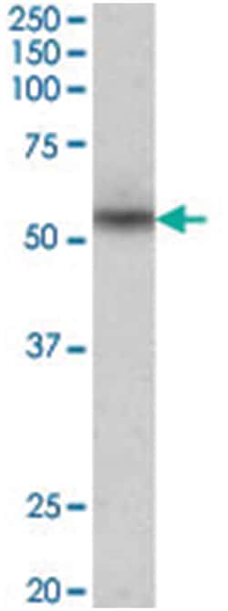 Mare, Goat, Polyclonal Antibody, Abnova 100 &mu;g | Buy Online | Abnova Corporation | Fisher Scientific