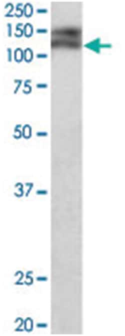 Pard3b, Goat, Polyclonal Antibody, Abnova 100&mu;g; Unlabeled:Antibodies,