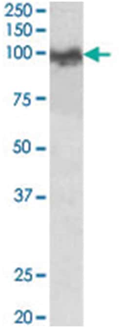 App, Goat, Polyclonal Antibody, Abnova 100 &mu;g | Buy Online | Abnova Corporation | Fisher Scientific