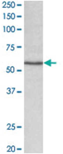 Cyp1a1, Goat, Polyclonal Antibody, Abnova 100 &mu;g | Buy Online | Abnova Corporation | Fisher Scientific