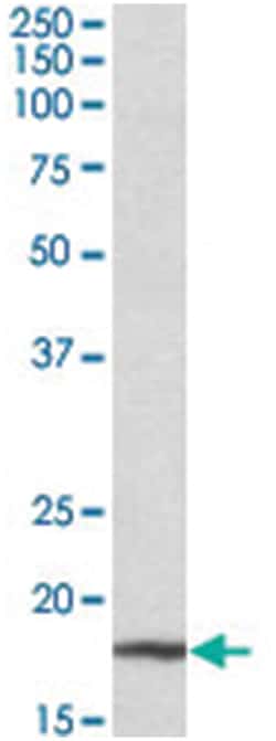 Cdkn2a, Goat, Polyclonal Antibody, Abnova 100 &mu;g | Buy Online | Abnova Corporation | Fisher Scientific
