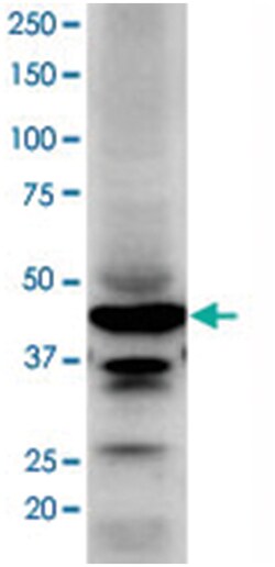 CD38 Rabbit anti-Human, Polyclonal Antibody, Abnova 100 &mu;L | Buy Online | Abnova Corporation | Fisher Scientific