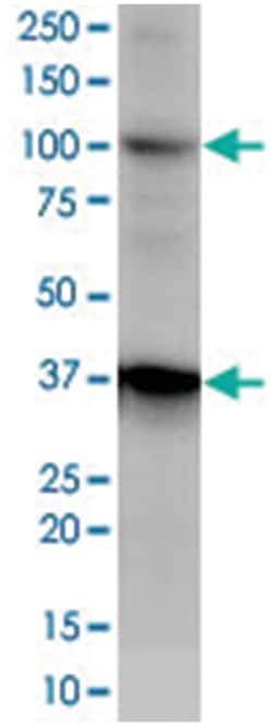 CD68 Rabbit anti-Human, Polyclonal Antibody, Abnova 100 &mu;L | Buy Online | Abnova Corporation | Fisher Scientific