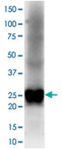 Lambda Light Chain Rabbit anti-Human, Polyclonal Antibody, Abnova 100 &mu;L | Buy Online | Abnova Corporation | Fisher Scientific