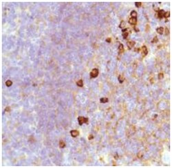 Lambda Light Chain Rabbit anti-Human, Polyclonal Antibody, Abnova 100 &mu;L | Buy Online | Abnova Corporation | Fisher Scientific
