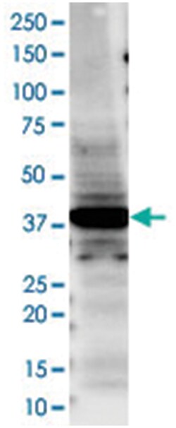 TTF1 Rabbit anti-Human, Polyclonal Antibody, Abnova 100 &mu;L | Buy Online | Abnova Corporation | Fisher Scientific