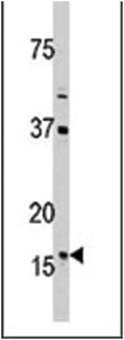TXN2 Rabbit anti-Human, Polyclonal Antibody, Abnova 400 &mu;L | Buy Online | Abnova Corporation | Fisher Scientific