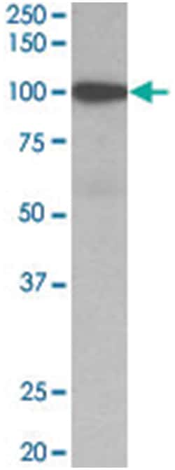 GSN Goat anti-Human, Polyclonal Antibody, Abnova 100 &mu;g | Buy Online | Abnova Corporation | Fisher Scientific