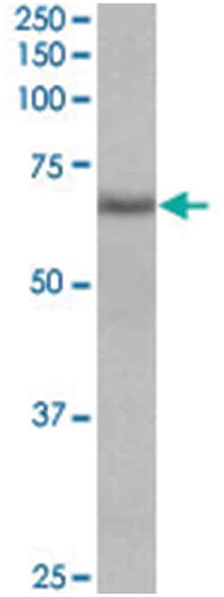 Cyb5r4, Goat, Polyclonal Antibody, Abnova 100 &mu;g | Buy Online | Abnova Corporation | Fisher Scientific