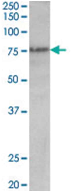 Trp63, Goat, Polyclonal Antibody, Abnova 100 &mu;g | Buy Online | Abnova | Fisher Scientific