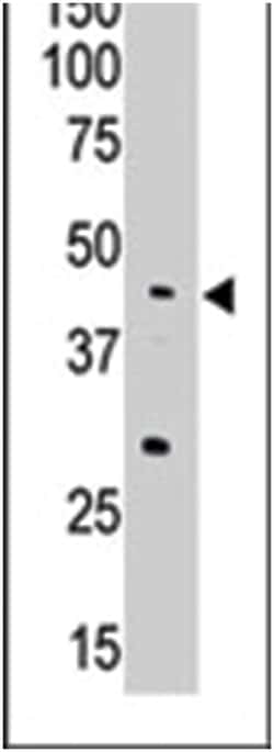 APOBEC3G Rabbit anti-Human, Polyclonal Antibody, Abnova 400&mu;L; Unlabeled:Antibodies,