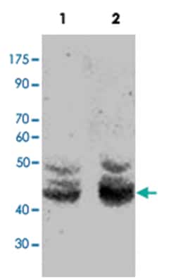 PAX2 Rabbit anti-Mouse, Rat, Polyclonal Antibody, Abnova 100 &mu;g | Buy Online | Abnova Corporation | Fisher Scientific