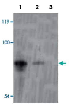 INAD, Rabbit, Polyclonal Antibody, Abnova 100 &mu;g | Buy Online | Abnova Corporation | Fisher Scientific