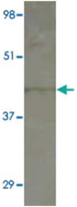 SLC9A3 Rabbit anti-Human, Mouse, Rat, Polyclonal Antibody, Abnova 100 &mu;g | Buy Online | Abnova Corporation | Fisher Scientific