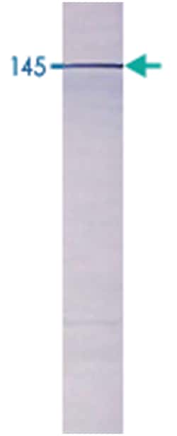 Pde3b, Rabbit, Polyclonal Antibody, Abnova 100 &mu;g | Buy Online | Abnova | Fisher Scientific