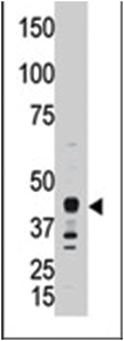 APOBEC3G Rabbit anti-Human, Polyclonal Antibody, Abnova 400 &mu;L | Buy Online | Abnova | Fisher Scientific