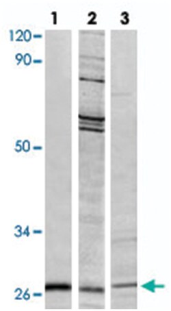 HSPB1 (phospho S78), Rabbit anti-Human, Mouse, Rat, Polyclonal Antibody,