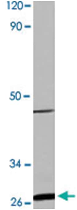 HSPB1 (phospho S82), Rabbit anti-Human, Polyclonal Antibody, Abnova 100 &mu;L | Buy Online | Abnova Corporation | Fisher Scientific