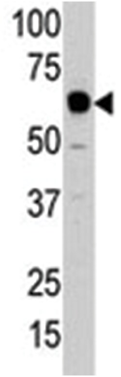 APOBEC1, Rabbit, Polyclonal Antibody, Abnova 400 &mu;L | Buy Online | Abnova Corporation | Fisher Scientific