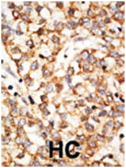 APOBEC1, Rabbit, Polyclonal Antibody, Abnova 400 &mu;L | Buy Online | Abnova Corporation | Fisher Scientific