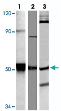 FYN (phospho Y530), Rabbit anti-Human, Mouse, Rat, Polyclonal Antibody, Abnova 100 &mu;L | Buy Online | Abnova Corporation | Fisher Scientific