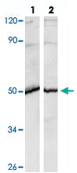 MAP2K1 (phospho S298), Rabbit anti-Human, Polyclonal Antibody, Abnova 100 &mu;L | Buy Online | Abnova Corporation | Fisher Scientific