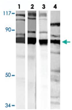 PRKCA (phospho T638), Rabbit anti-Human, Mouse, Polyclonal Antibody, Abnova 100 &mu;L | Buy Online | Abnova Corporation | Fisher Scientific