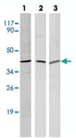SOX2 Rabbit anti-Human, Mouse, Rat, Polyclonal Antibody, Abnova 100 &mu;L | Buy Online | Abnova Corporation | Fisher Scientific