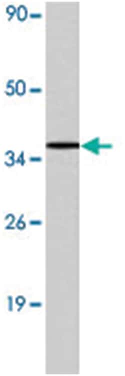 LYVE1 Rabbit anti-Human, Polyclonal Antibody, Abnova 100 &mu;L | Buy Online | Abnova Corporation | Fisher Scientific